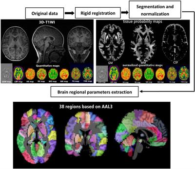 Application of Quantitative Magnetic Resonance Imaging in the Diagnosis of Autism in Children